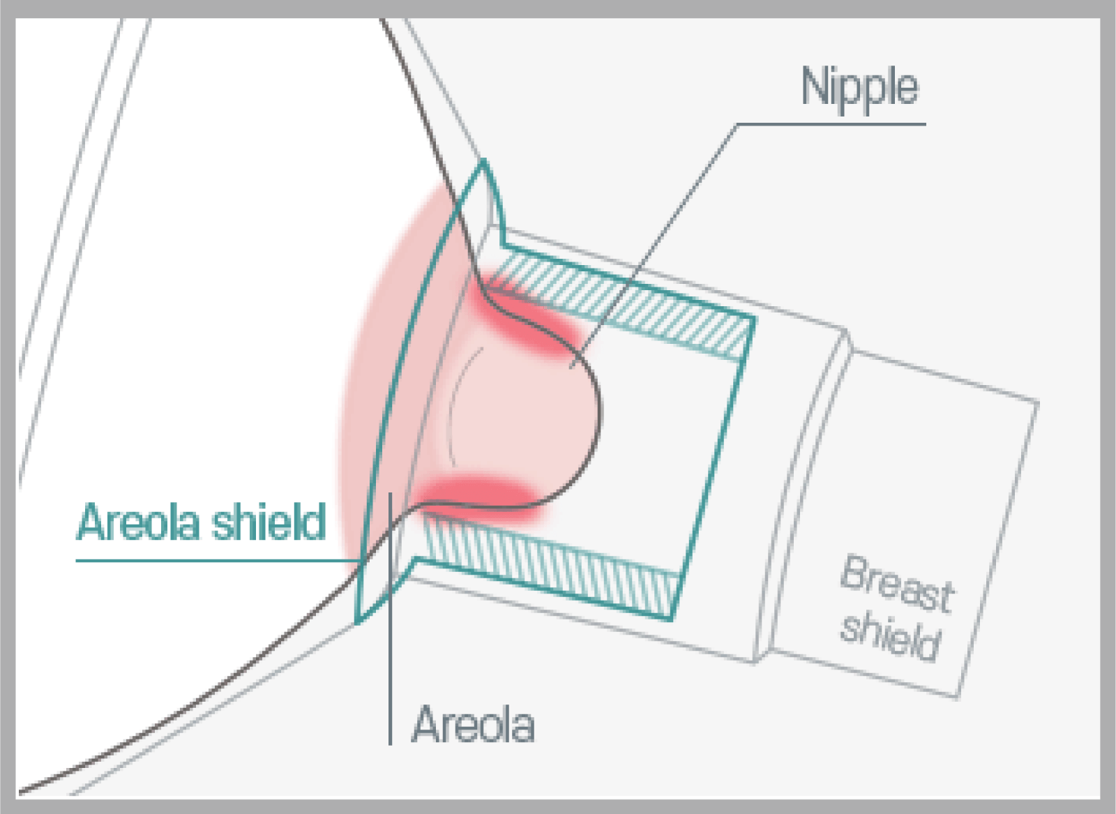 Larger size areola shield